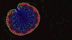 A revolutionary therapy could eliminate 92% of cancer cells while preserving healthy tissue